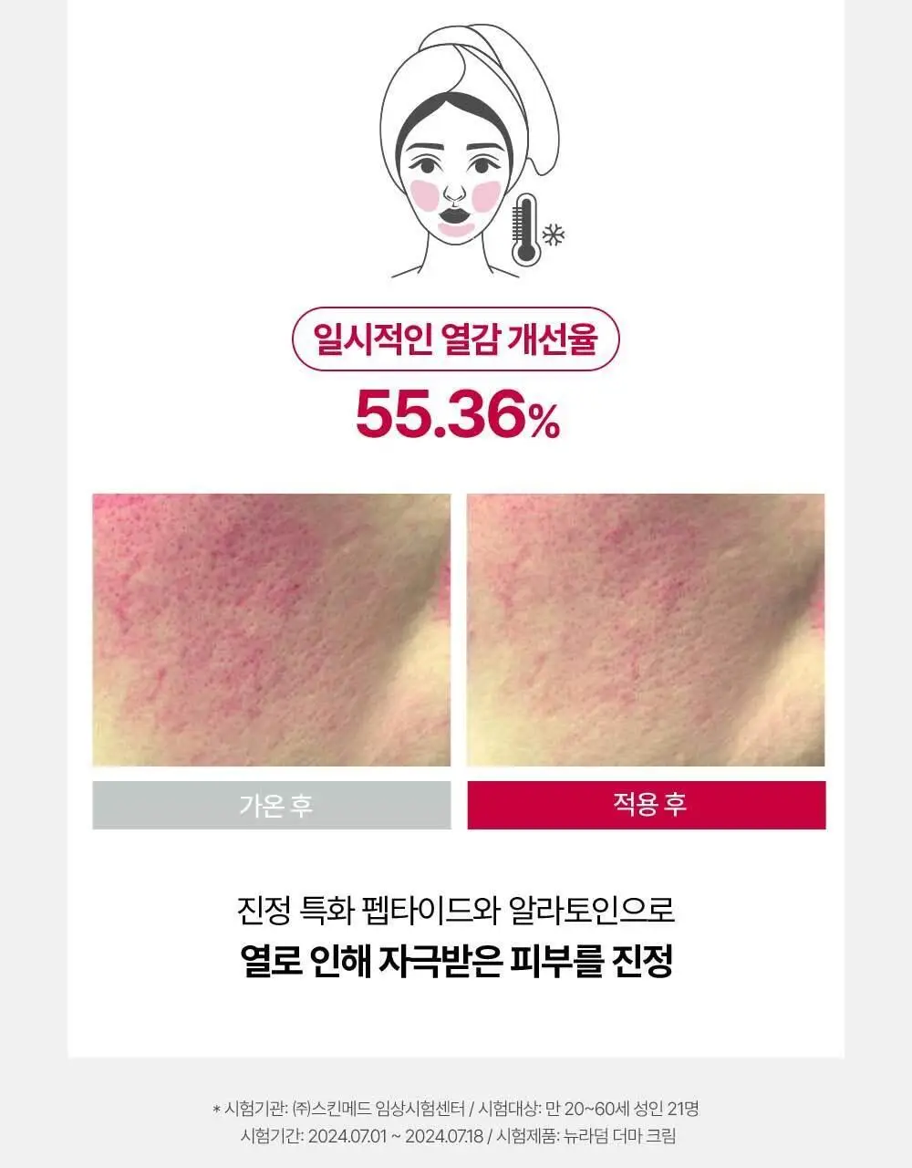 [화잘먹크림] 메디톡스 뉴라덤 더마크림 100g [기획(+20g)/단품] 상세페이지 7